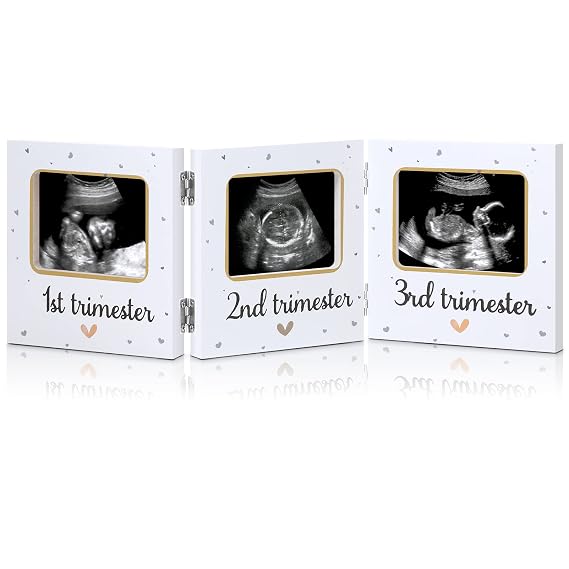 Amyhill Triple Ultrasound Picture Frames, Baby Sonogram Photo Frame Pregnancy Ultrasound Keepsake Frame, Gift for Expecting Parents, Baby Shower Nursery Decor, White